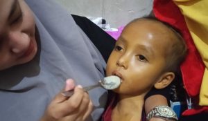 Menderita TBC Otak, Ahmad Musaddad Warga Pekon Sri Melati Wonosobo Tanggamus Butuh Uluran Tangan