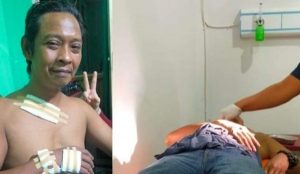 Anjing Gila Berkeliaran Di Wajo, 2 Warga Jadi Korban