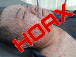 IMIP Klarifikasi Terkait Informasi Hoaks Cacar Monyet Di Kawasan Industri