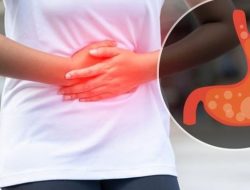 Kanker lambung, waspadai gejalanya yang bervariasi
