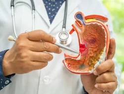 Waspadai gejala awal kanker lambung